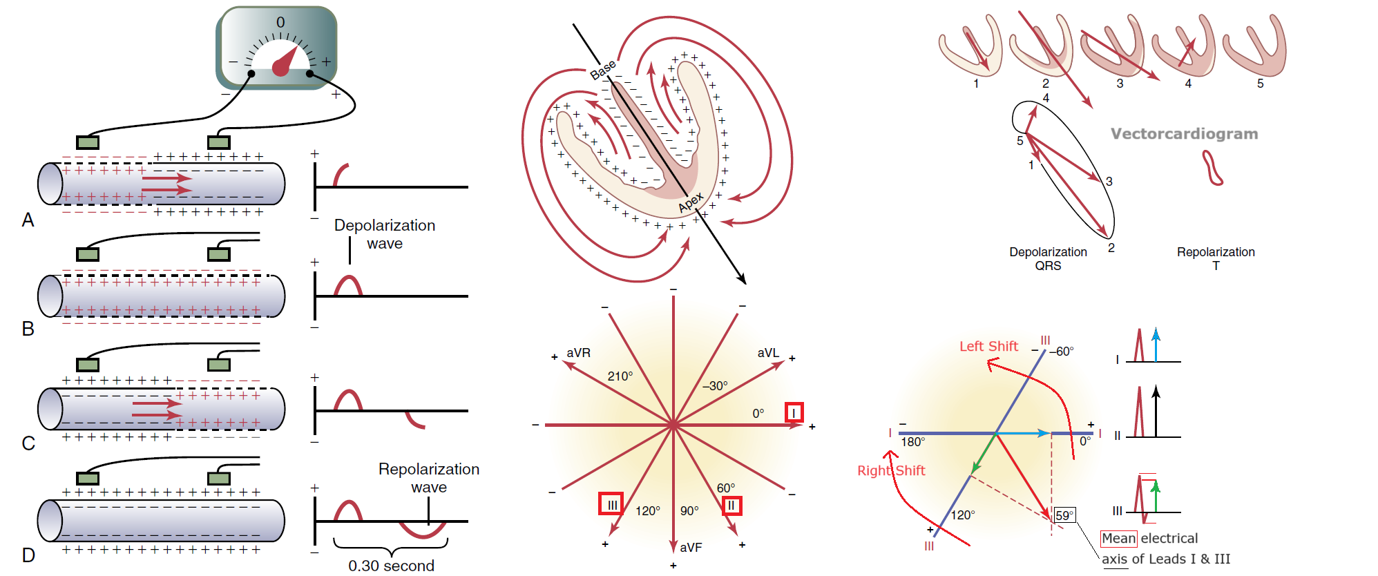 Figure 11-2