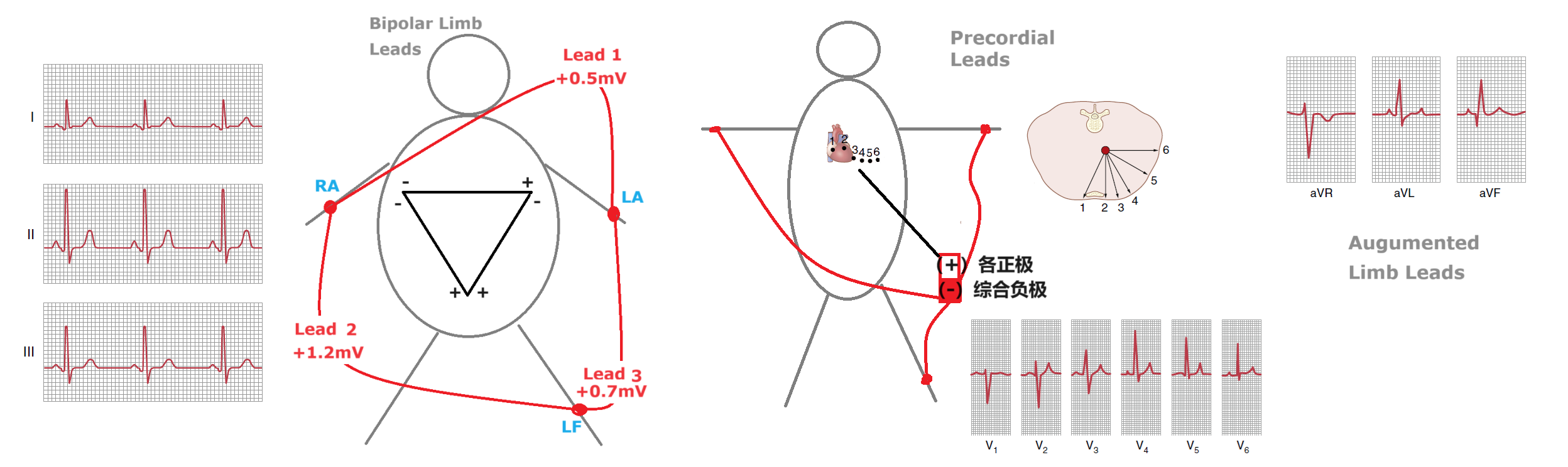 Figure 11-3