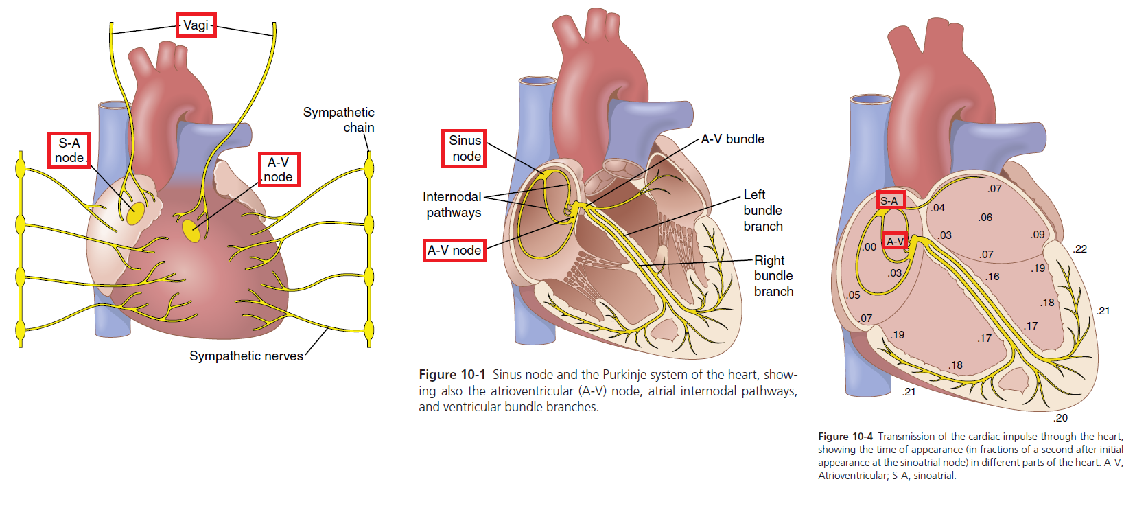 Figure 9-14